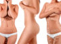 Would You Gain Weight After Having Liposuction
