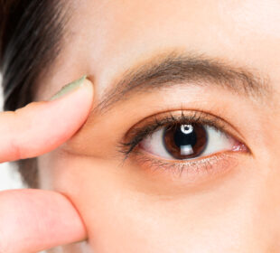 Discovering The Benefits Of Double Eyelid Surgery