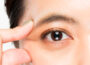 Discovering The Benefits Of Double Eyelid Surgery