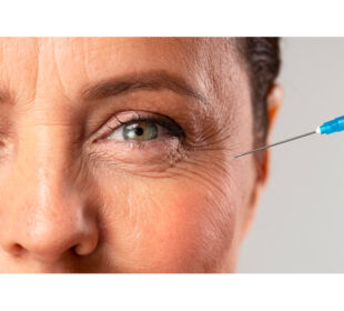 Embrace Youthful Radiance Lip Fillers and Anti Wrinkle Injections in Sydney