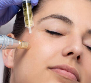 Embracing Innovation Microneedling and TruBody by Cutera in Miami