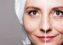 Reveal a Smoother Youthful Look with the Power of Laser Wrinkle Removal