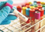Post Treatment Care Recovery and Lifestyle Tips from StemCellCure Experts
