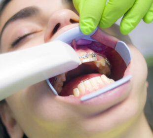 Modern Dental Solutions for the Whole Family