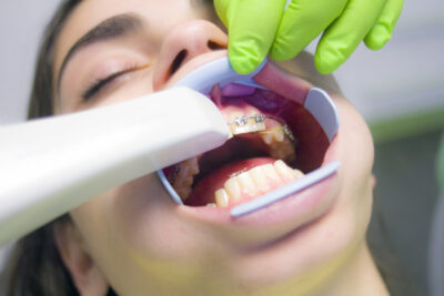 Modern Dental Solutions for the Whole Family