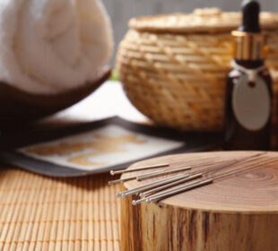 How to Get Relief Without Pills by Acupuncture in Singapore