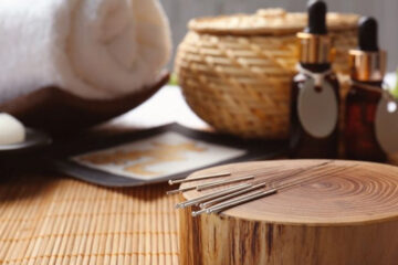 How to Get Relief Without Pills by Acupuncture in Singapore