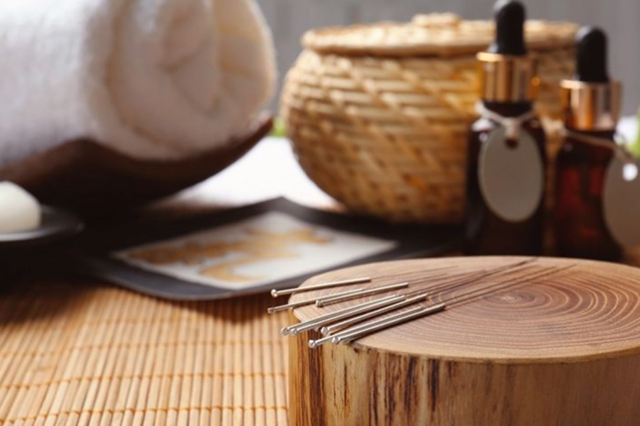 How to Get Relief Without Pills by Acupuncture in Singapore