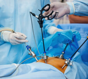 Laparoscopic Surgery Training How Will It Benefits Surgeons