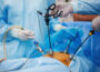 Laparoscopic Surgery Training How Will It Benefits Surgeons