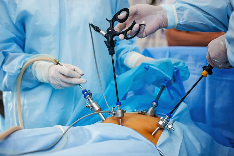 Laparoscopic Surgery Training How Will It Benefits Surgeons
