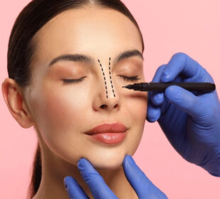 Rhinoplasty What Defines the Best Nose Surgeon Today