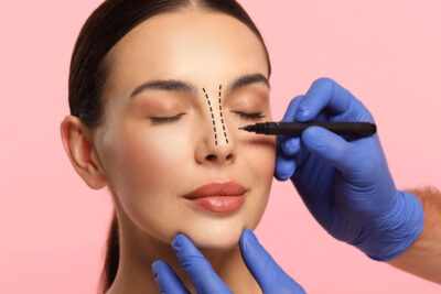 Rhinoplasty What Defines the Best Nose Surgeon Today