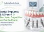 Dental Implants and All on 4 in San Jose Cupertino and Santa Clara A Modern Path to a Complete Smile
