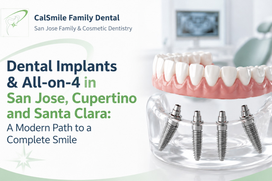 Dental Implants and All on 4 in San Jose Cupertino and Santa Clara A Modern Path to a Complete Smile