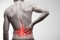 Why Back Pain Can Develop Without a Major Accident or Injury