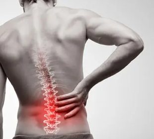Why Back Pain Can Develop Without a Major Accident or Injury